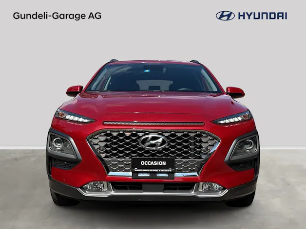 Hyundai Kona 1.6 CRDI Vertex 4WD