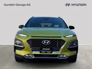 Hyundai Kona 1.6 CRDI Vertex 4WD