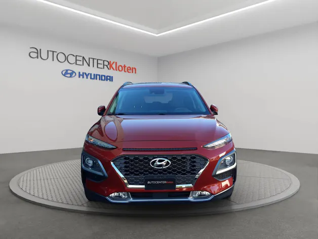 Hyundai Kona 1.6 CRDi Vertex 4WD