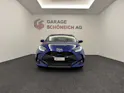 Toyota Yaris 1.5 VVT-i HSD Trend